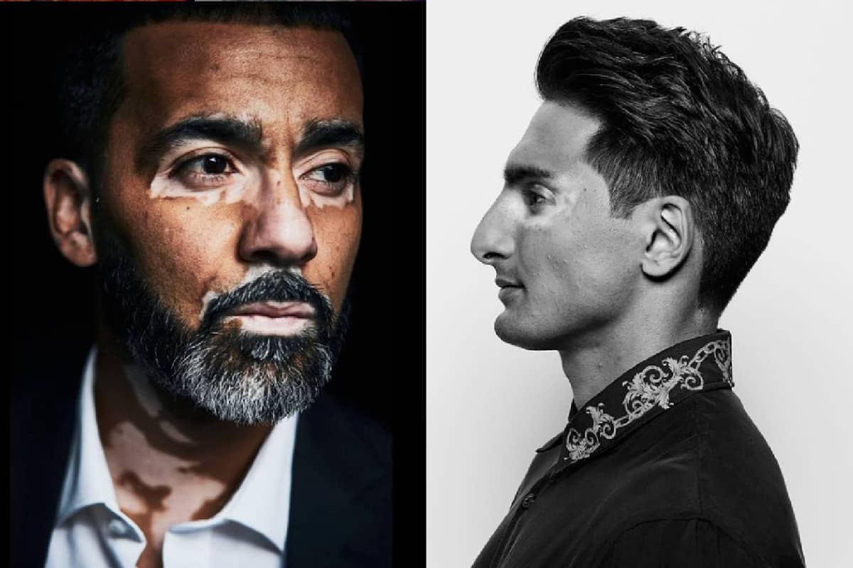 Ode aan de ‘imperfecte’ huid