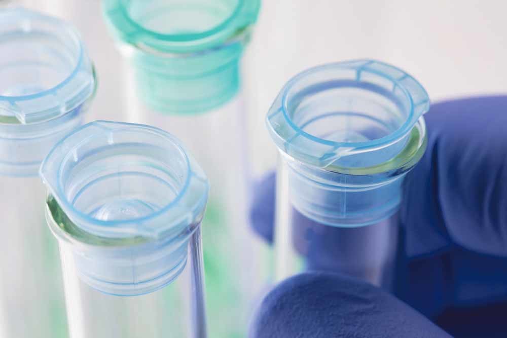 My Green Lab helpt wetenschappers en managers van laboratoria om de hoeveelheid afval te reduceren, het energieverbruik te verminderen en over te stappen op duurzamere chemicaliën en producten. – © Unsplash
