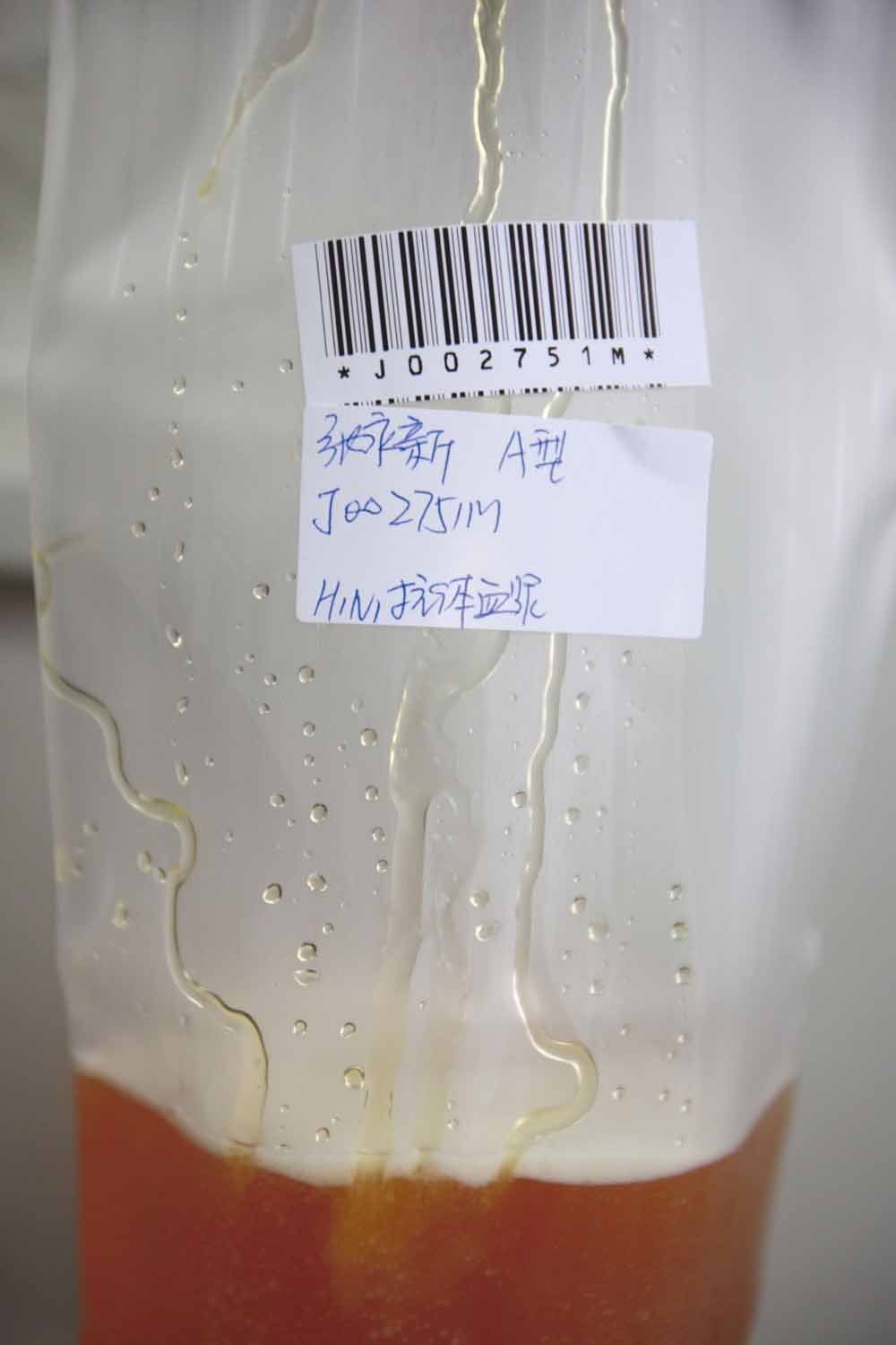 Het bloedplasma van Chinees die hersteld is van het H1N1-virus. – © China Photos