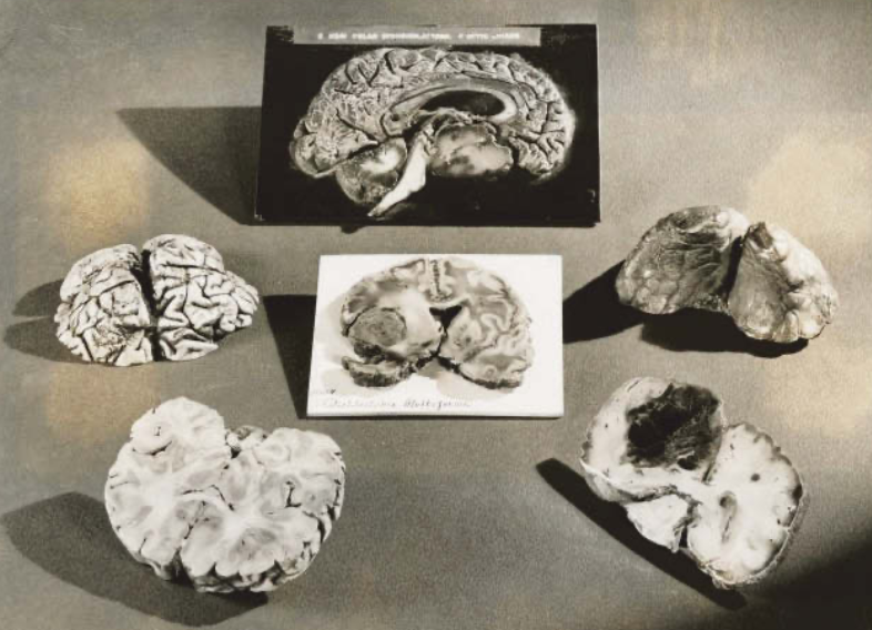 In plastic gecoate doorsnedes van hersenen voor de Wereldtentoonstelling van 1939-1940 in New York. Neurowetenschapper Kay Tye onderzoekt in welke hersendelen eenzaamheid ontstaat. © The New York Public Library