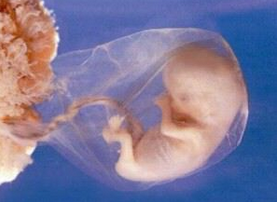 Embryo van 13 weken.
